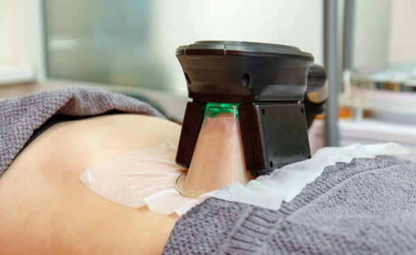 Cryotherapy – Fat Freeze