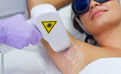 IPL Laser Hair Removal
