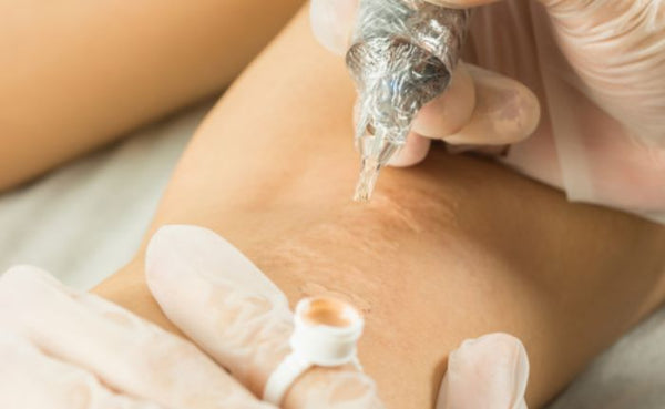 Scar and Stretch Mark Camouflage Training Course