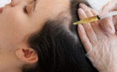 Advanced Scalp Micro Pigmentation Training Course